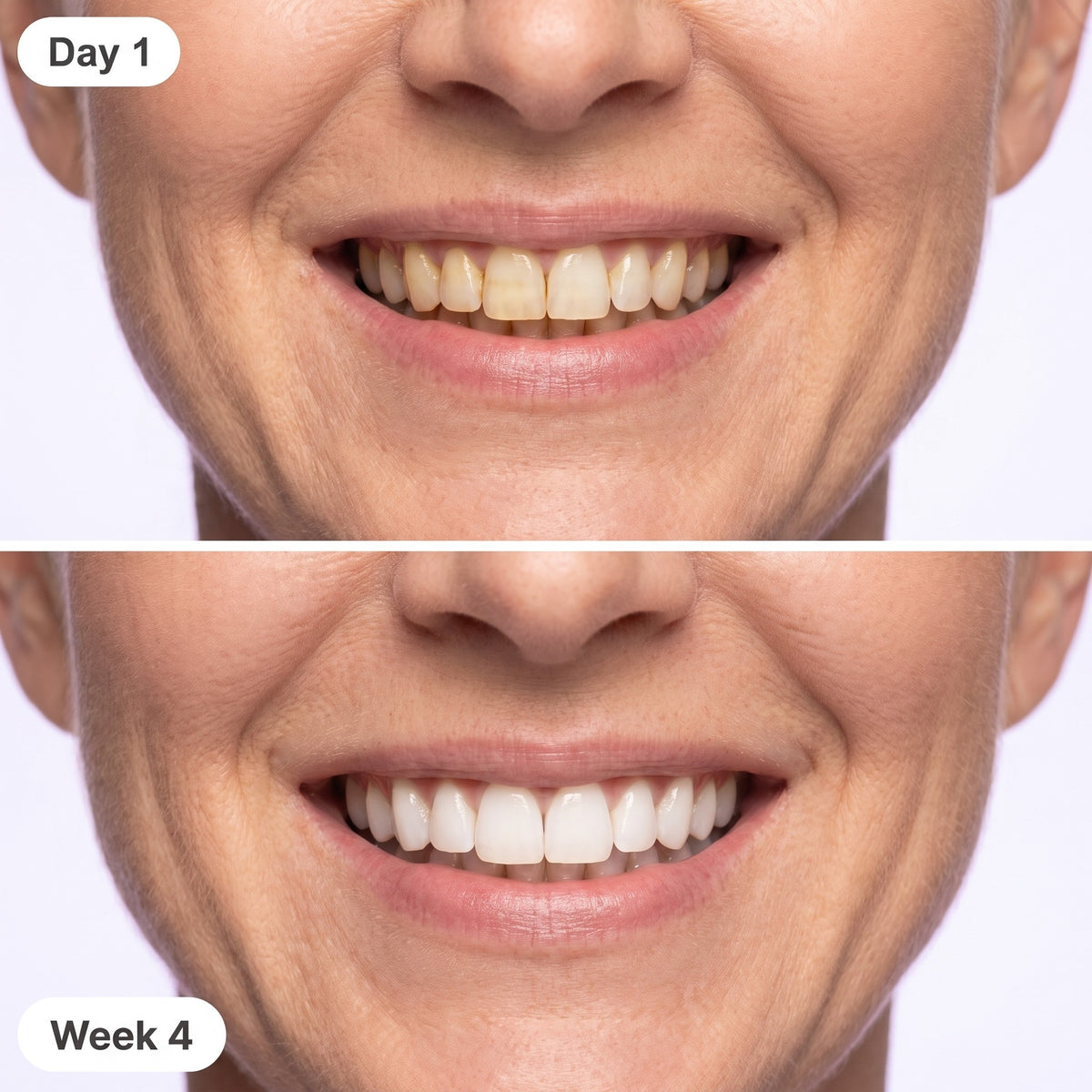Before and after: day 1 coffee stains, week 4 brighter smile